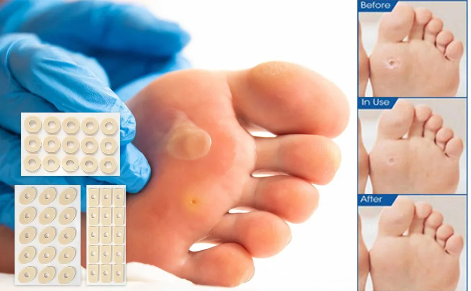 Corn dressing corns protective dressing foot corn dressing protective foot corn foot protector toe correctors silicone corns dressing 45 pieces - product information 4