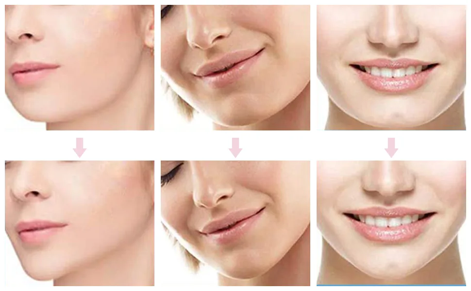 Face Lifting Tape Facelifting Sticker Facelift Tape Lift Face Sticker Face Lift Patch Invisible Thin Face Sticker V-Shape Face Concealing Makeup Facelift Tools 40 Pieces - 7 US