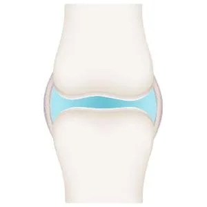 JointGel Formula - Purity Products - Collagen Peptides + MSM - Supports Joint Flexibility + Fortify Joint Cartilage - Berry Powder - 30 Day Supply - healthy knee joint