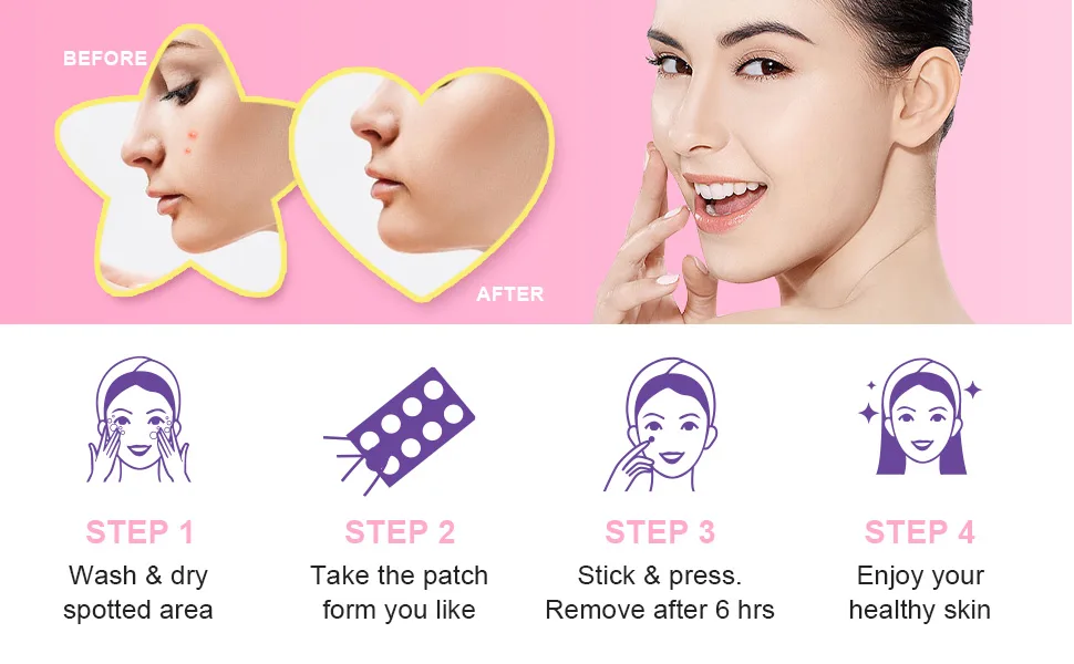Acne Patch Pimple Patch Star Shaped Acne Absorbing Cover Patch Hydrocolloid Acne Patches For Face Zit Patch Acne Dots Tea Tree Oil + Centella 96 Patches 9mm&12mm - Acne Pimple Patches
