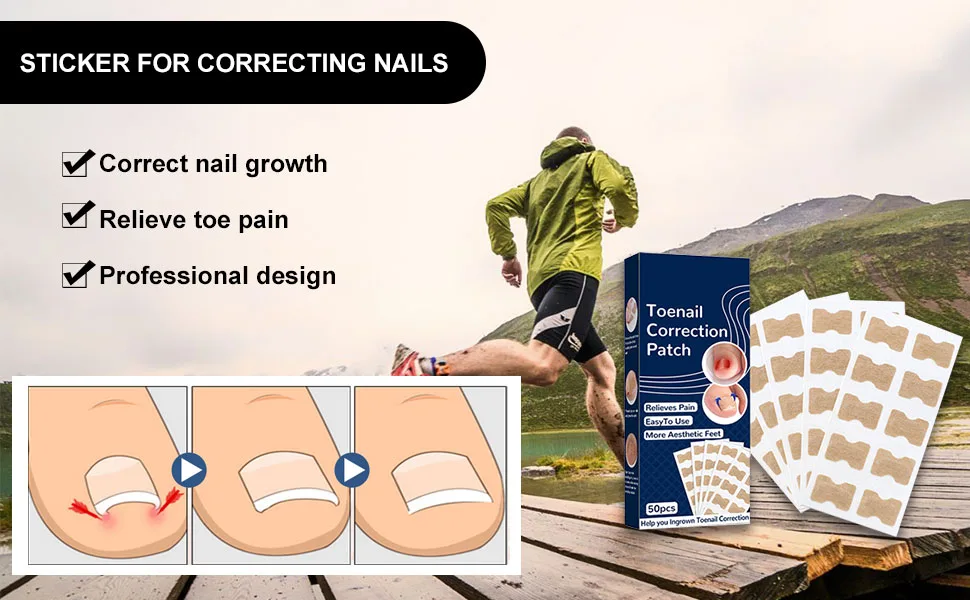 Toenail Patch Toenail Correction Patch Toenail Correction Patch Corrector Pedicure Ingrown Toenails Tool for Ingrown Toenails 50 Pieces - product information 4