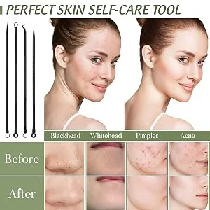Greoer 4 Pieces Blackhead Remover Tool Kit Comedone Extractor Acne Removal Kit Stainless Steel Black Head Tool Remove for Face Care (Black) - 4 Pieces Blackhead Remover Tool Kit