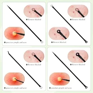 Greoer 4 Pieces Blackhead Remover Tool Kit Comedone Extractor Acne Removal Kit Stainless Steel Black Head Tool Remove for Face Care (Black) - 4 Pieces Blackhead Remover Tool Kit