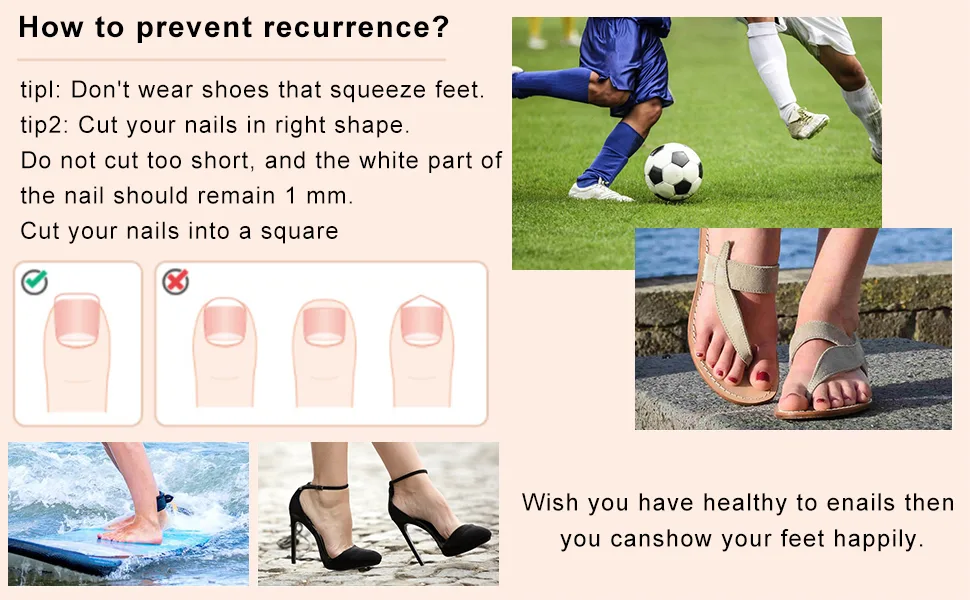 Toenail Corrector Patch Ingrown Nail Corrector Ingrown Nail Treatment Ingrown Nail Corrector Stickers Toenail Correction Toenail Patch - product information 4