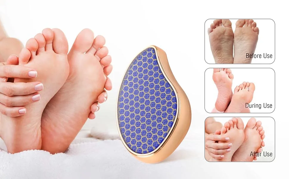 Nano Glass Heel Scraper (Blue Honeycomb) - foot file
