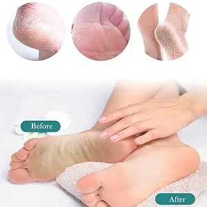 Glass Callus Remover - Multipurpose Glass Callus Remover Portable Foot Care Tools User-Friendly Callus Shaver for Wet & Dry Skin Diamond - Simple to Clean