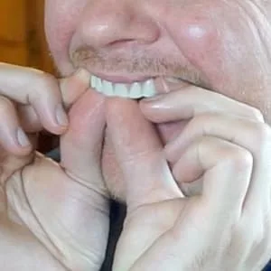Instant Smile Comfort Fit Flex - Bright White - Upper Veneer Cosmetic Teeth - Fitting the Instant Smile Teeth