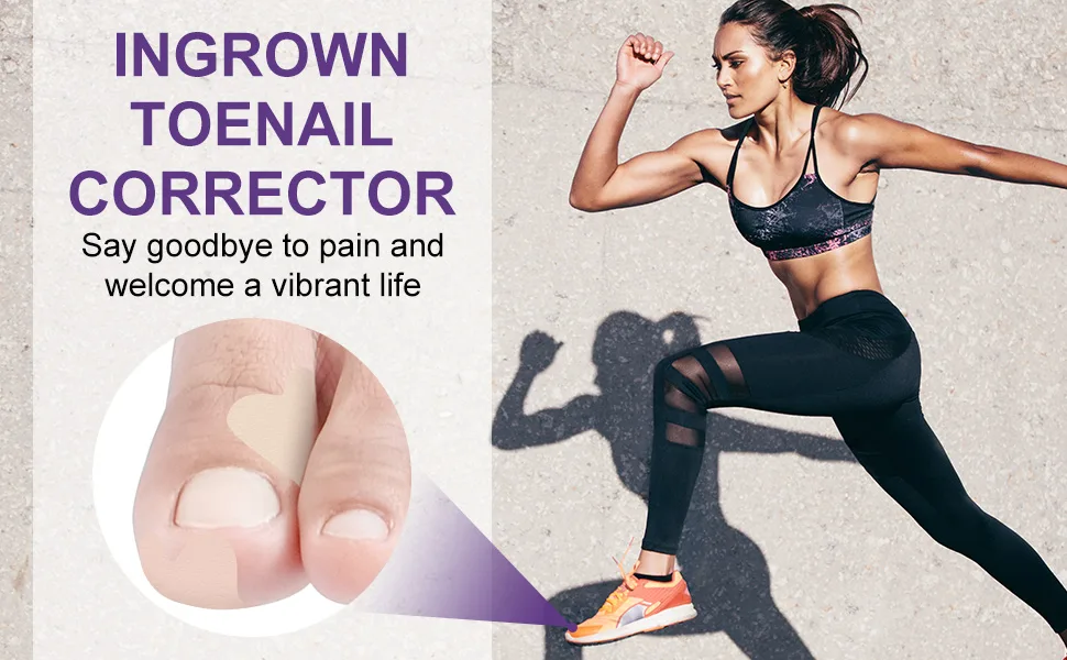 Ingrown Toenail Corrector, Ingrown Toenail Treatment, Glue-Free Toenail Corrector Patch, 50 Pcs - product information 1