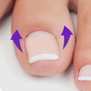 Ingrown Toenail Corrector, Ingrown Toenail Treatment, Glue-Free Toenail Corrector Patch, 50 Pcs - product information 2