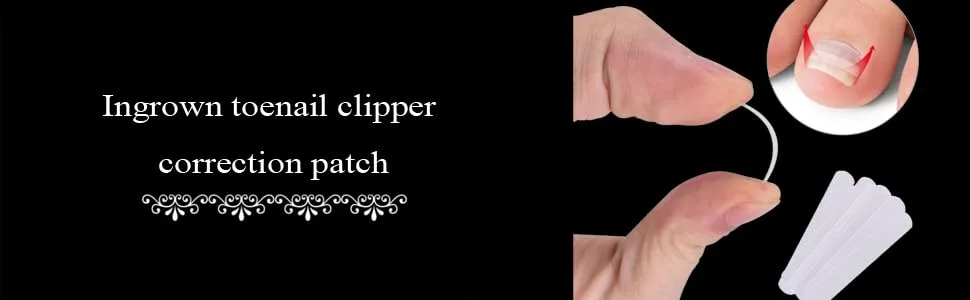 Ingrown Toenail Corrector Strips Brace 10pcs/bottle Straightener Clip Curved BS Brace Toenails Thick Correction Foot Tool - gnker ingrown toenail clipper patch