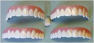 Imako Cosmetic Teeth 1 Pack. (Small, Bleached) Uppers Only- Arrives Flat. Fit at Home Do it Yourself Smile Makeover! 1 Count (Pack of 1) - product information 1