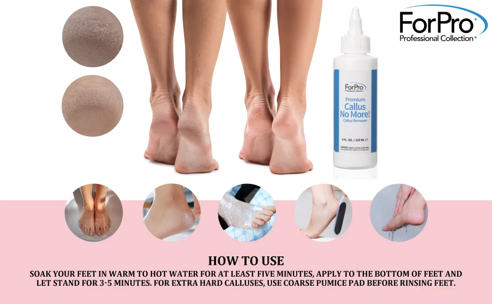 ForPro Premium Callus No More! Callus Remover, Fast-Acting Callus Removing Formula, 32 oz. 32 Ounce - product information 7