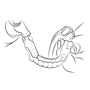 EverSmile AlignerFresh Extra Whitening Aligner & Retainer Cleaning Foam, Aligner Cleaner and Whitener Foam - WhiteFoam Step 1