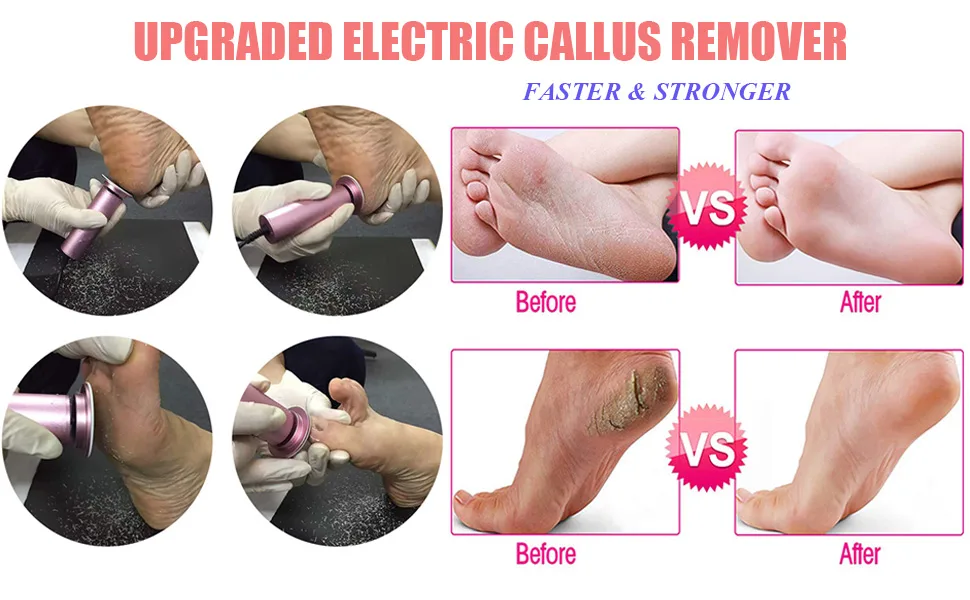 Electric Callus Remover, Ravifun Foot File Pedicure Tool with Speed Controller and 60pcs Replacement Sandpaper Disk for Men Women Dead Dry Crack Skin Calluses - product information 3