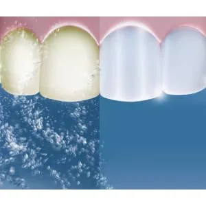Efferdent Plus Mint Anti-Bacterial Denture Cleanser | 90 Tablets - Oxi-Action