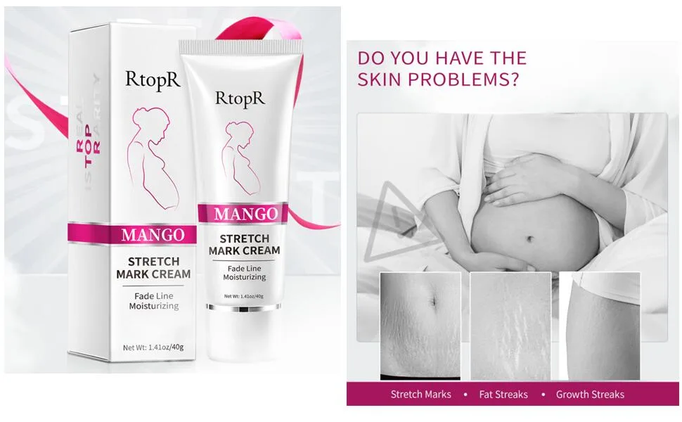 Stretch Mark Removal Cream Obesity Stretch Mark Moisturizer Postpartum Repair Stretch Mark Cream Abdominal Stretch Mark Cream Remove Marks (2 PCS) - renshenwen-16
