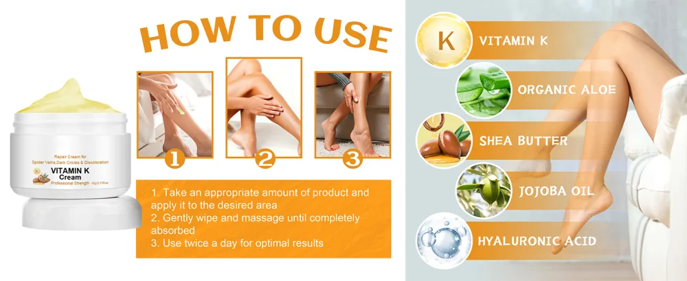 Vitamin K Cream Varicose Veins Miracle Cream Spider Varicose Veins Miracle Cream Remove Varicose Veins for Legs (1pcs) - Vitamin K Cream