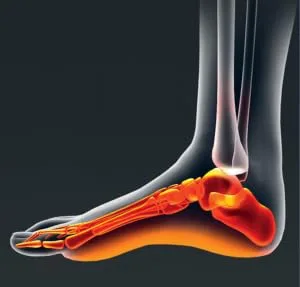 Dr. Scholl's SORE SOLES Pain Relief Orthotics (for Men's 8-14, also available for Women's 6-10), 1 Pair - product information 4