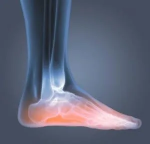 Dr. Scholl's SORE SOLES Pain Relief Orthotics (for Men's 8-14, also available for Women's 6-10), 1 Pair - product information 5