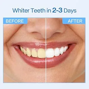 Teeth Whitening Strips for Sensitive Teeth - Professional White Strips for Home Using Enamel safe 3 Days Express Result 28 Natural Teeth Whitener Strips 14 Treatments by Deepklean Coconut - teeth whitening strips