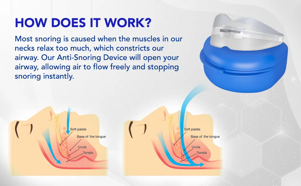 Anti Snoring Devices: Effective Snoring Solution - Snore Guard Anti-snoring Device - Snoring Mouth Guard - Anti Snore Mouthpiece for Stop Snoring (Green) - How Does It Work