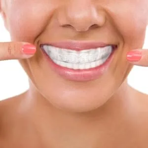 1Pc Practical Durable Exquisite Portable Adult Brace Teeth Straightening - product information 5