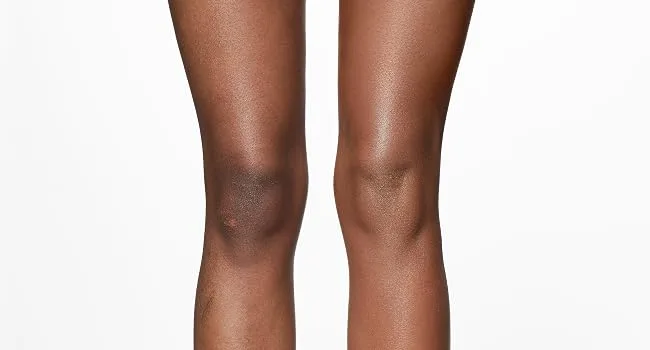 Dermablend Leg & Body Foundation Makeup For Legs Veins Stretch marks Buildable Liquid Body Foundation 100mL 10n Fair Ivory - before & after