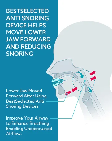 Anti Snoring Mouth Guard Device: Medium Anti Snoring Devices Ronflement Solution - Stop Snore Guard Mouthpiece Sleeping Mouth Stopper - Sleep Apnea Devices (Blue) - Snoring Solution