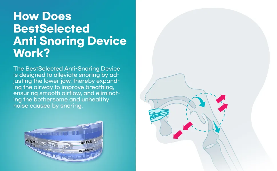 Anti Snoring Mouth Guard Device: Medium Anti Snoring Devices Ronflement Solution - Stop Snore Guard Mouthpiece Sleeping Mouth Stopper - Sleep Apnea Devices (Blue) - anti snoring devices