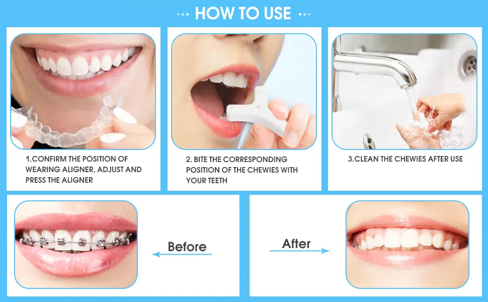 Y-Kelin Y-Shaped Aligner Chewies for Invisalign Trays Aligner Trays Seater- Teeth Chewies for Orthodontic (Green+White soft) - chewies