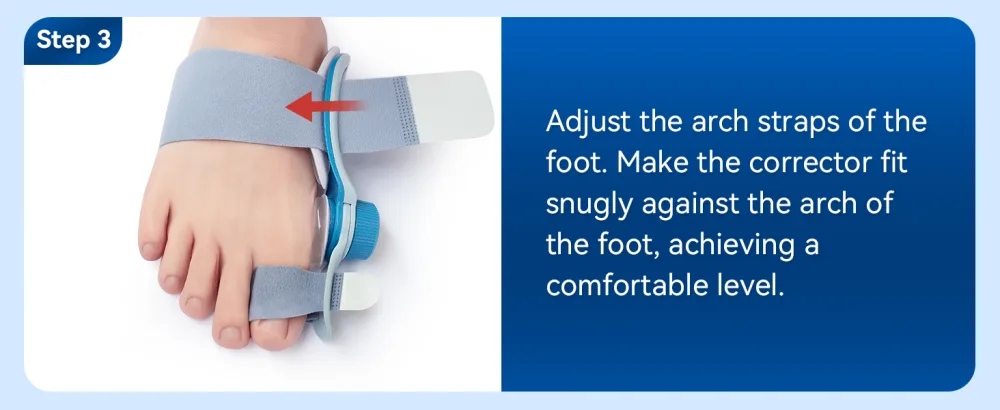 Tech Love Bunion Correctors for Women & Men Adjustable Knob Double Correction Toe Separator for Big Toe Relief Bunion Splints Hammer Toe Straightener with Silicone Pad Comfortable Effective (1PC) Blue - product information 19