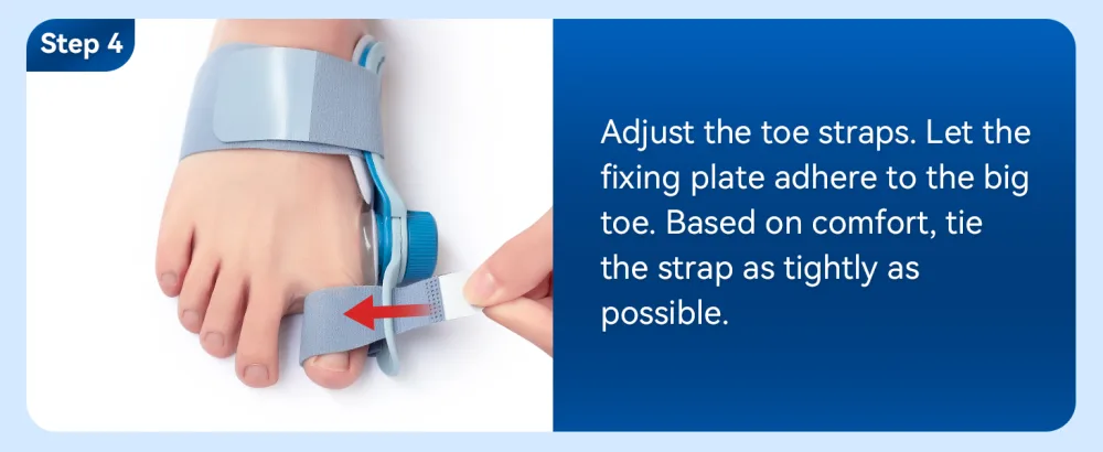 Tech Love Bunion Correctors for Women & Men Adjustable Knob Double Correction Toe Separator for Big Toe Relief Bunion Splints Hammer Toe Straightener with Silicone Pad Comfortable Effective (1PC) Blue - product information 20