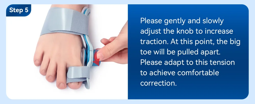 Tech Love Bunion Correctors for Women & Men Adjustable Knob Double Correction Toe Separator for Big Toe Relief Bunion Splints Hammer Toe Straightener with Silicone Pad Comfortable Effective (1PC) Blue - product information 21