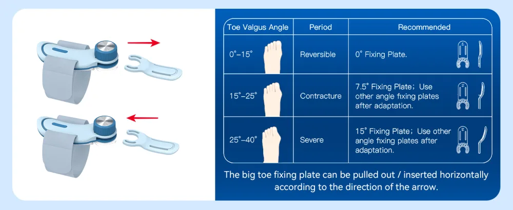 Tech Love Bunion Correctors for Women & Men Adjustable Knob Double Correction Toe Separator for Big Toe Relief Bunion Splints Hammer Toe Straightener with Silicone Pad Comfortable Effective (1PC) Blue - product information 22