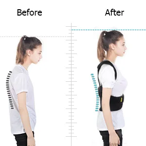Back Brace Posture Corrector Adjustable Back Support Back Straightener Posture Support Belt for Men and Women Relieve Back and Shoulder Pain - back support