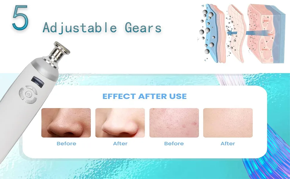 Handheld Diamond Microdermabrasion Machine Facial Skin Care Device Professional Microdermabrasion Device Blackhead Removal for Skin Care - 5 Gears