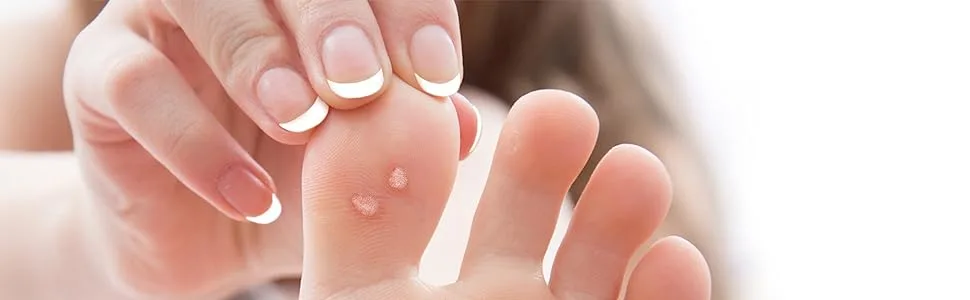 Care Science Wart Remover Freeze, 8 Applications | 1-Step Cryogenic Wart Removal for Common Warts on Hands, Elbows, & Knees or Plantar Warts on Feet - Care Science Wart Freeze Remover Cryogenic Removal 1-Step Hands Feet