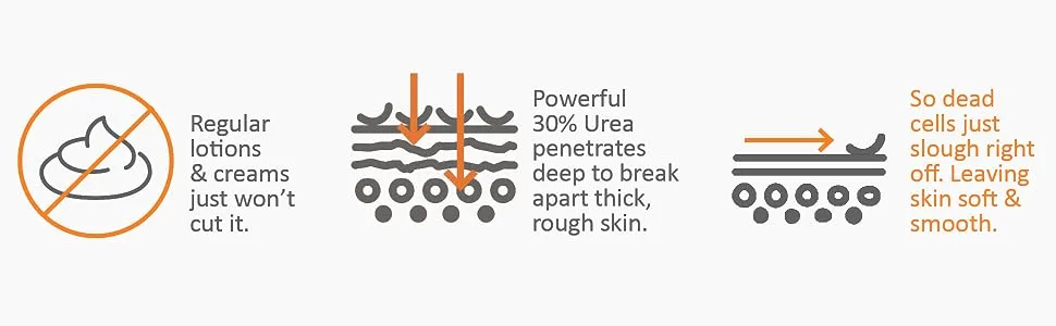 Callus Relief Stick with Powerful 30% Urea - Quick & Easy No-Mess Stick Helps Soften & Smooth Hard Thick Dry Cracked Rough Itchy Skin on Feet Legs Knees Elbows - powerful urea penetrates deep break apart debride remove slough dead skin cells smooth soft