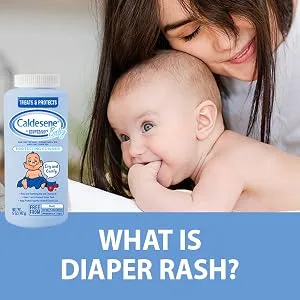 Caldesene Medicated Protecting Powder, Cornstarch & Zinc Oxide, Talc Free, 5oz - What is diaper rash?