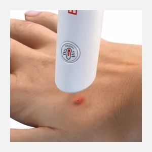 BITE HELPER- Mosquito and Bug bite Itch Relief- Award-Winning, Chemical-Free Treatment, Insect Sting and bite Relief. Dermatologist Tested, Bug bite First-aid, Anti-Itch Device (White) - activate bite helper