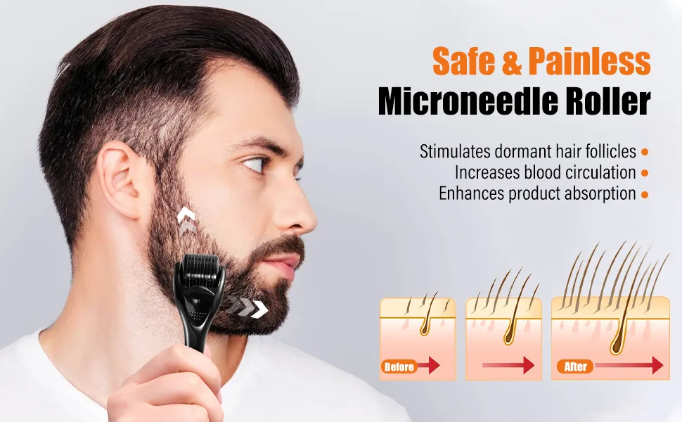Beard Derma Roller Microneedle Roller for Beard Growth, 0.25mm Derma Roller for Patchy Beard Growth Black - BG02