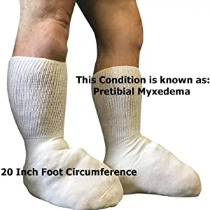 Bariatric Sock for Extreme Lymphedema Calf stretches to 30 inches Black - Extra Wide Socks