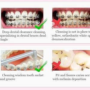 Chargenyang 8 PCS Interspace Toothbrush for Teeth Detail Cleaning and Braces Clean Soft and Compact Trim Tooth Toothbrush Rose Red Blue White - product information 4