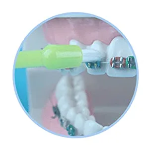Chargenyang 8 PCS Interspace Toothbrush for Teeth Detail Cleaning and Braces Clean Soft and Compact Trim Tooth Toothbrush Rose Red Blue White - product information 5