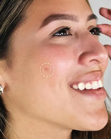 AUSLKA Blemish Patch Hydrocolloid Blemishes Patch Dots for Face Zit Patches Zit Stickers (9 Patches) 9 count (Pack of 1) - product information 3