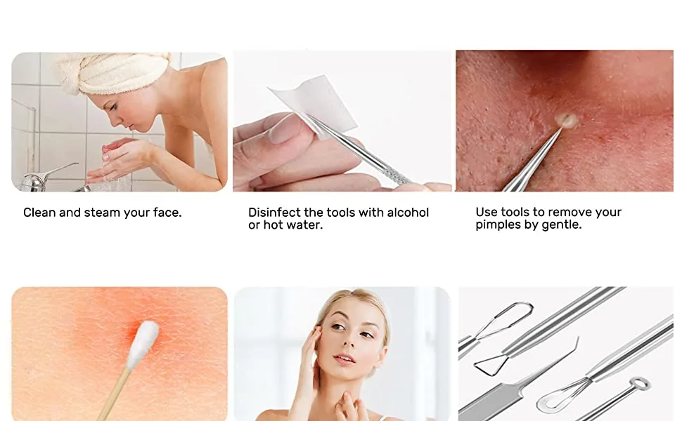Blackhead Remover Tool JOLIFILE Upgraded 9 Pcs Pimple Popper Tool Kit Extractor Tools with Tweezers Removal Comedone Whitehead Set Large Size-Silver - how to use the blackhead tool?