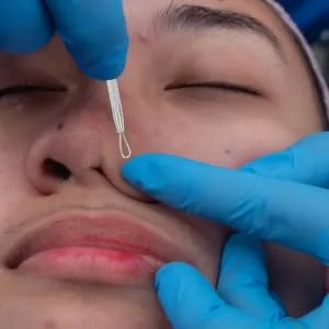 Outanaya Cleaning Tools 7pcs Tools Facial Cleaning Pore Extractor Comedone Pimple Removers Mixed Comedone Extractor - product information 2