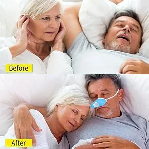 4 in 1 Anti snoring Devices,2021New Design Atomization snoring Solution,Right Amount Fog and moisturizing&PM2.5 Filter,Adjustable Wind Force Snore Stopper for Comfortable Sleep - Anti snoring Devices