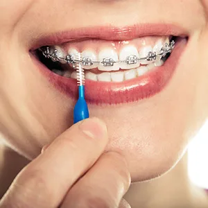 250 Pcs Floss Brushes Interdental Brush Teeth Soft Dental Picks Tooth Floss Interdental Brush Refill Dental Flosser Toothpick Cleaners Tooth Cleaning Tool - product information 5
