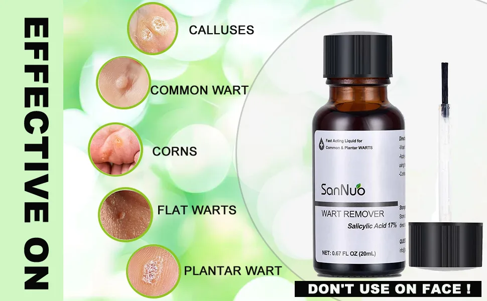 SANNUO Liquid Wart Remover for Common and Plantar Warts Fast Acting Gel Wart Remover Suitable for All Skin Types 0.67 FL OZ - product information 3